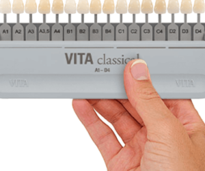 Teintiers vita